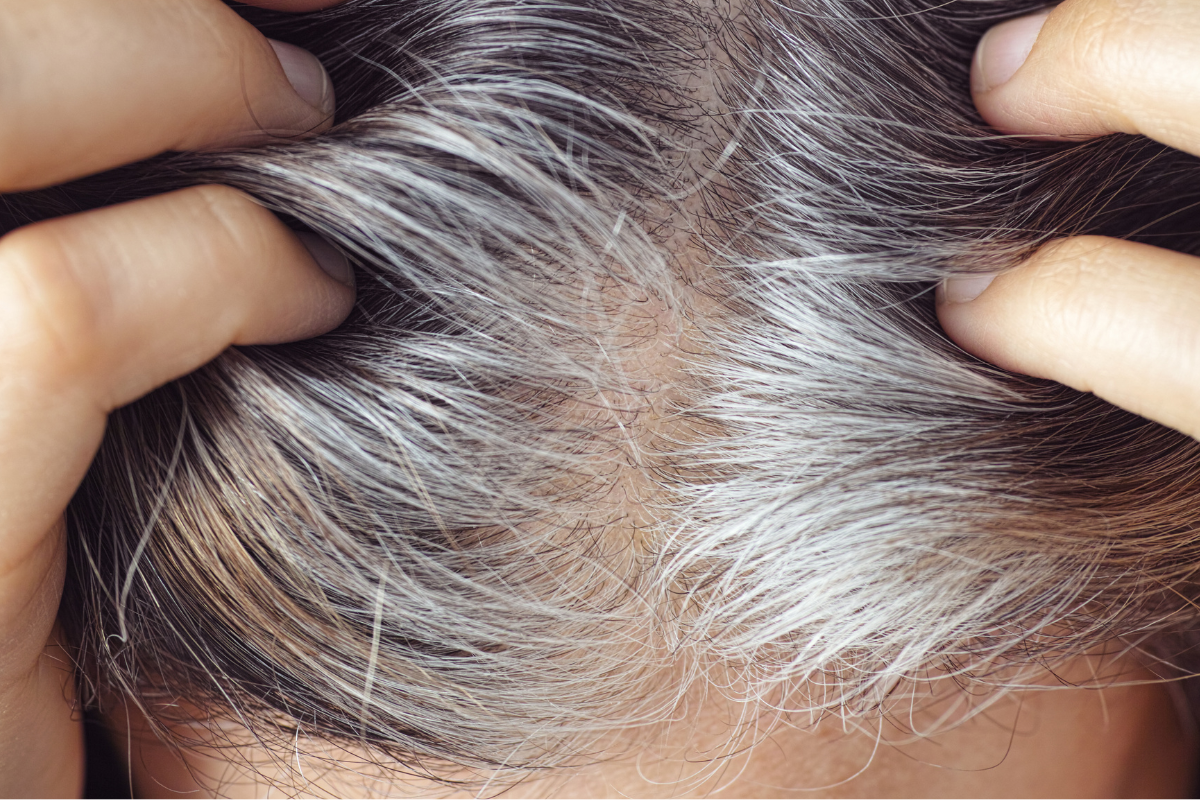 Grått hår beror på för lite melanin gray hair celloptimum