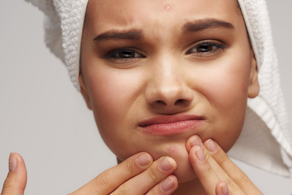 Kollagen - akne & hudproblem skin problems collagen acne